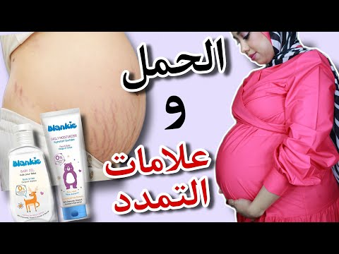 حامل لتاني مرة🤰🏻مرعوبه من علامات التمدد | بديل زيت جونسون | منتجات بلانكي للحوامل .