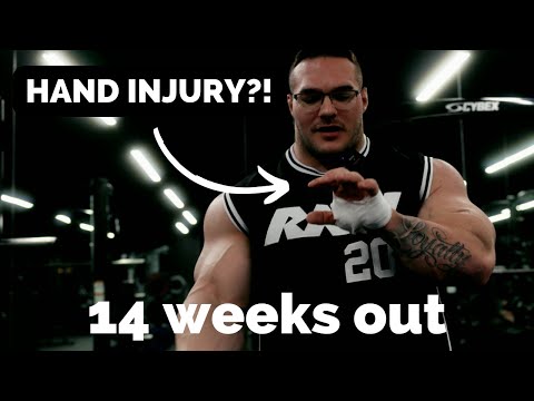 Nick Walker | HAND INJURY?? 14 WEEKS OUT