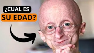 💔El Niño de 80 Años🧬: Un Corazón Joven Atrapado en el Cuerpo de un Anciano.