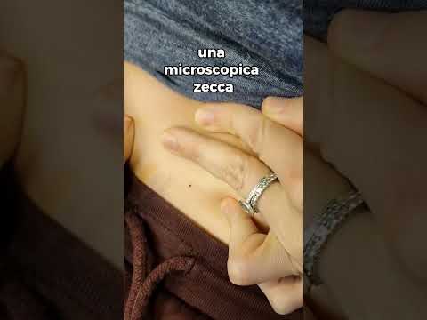 Ho preso una zecca: come la tolgo? #veterinaria #veterinario #zecca