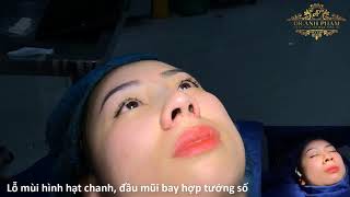 Nâng mũi đầu xuân - Khuân thêm tài lộc - DR. ANH PHẠM