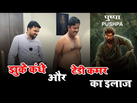 झुके कंधे और टेढ़ी कमर? सिर्फ 1 सेशन में इलाज | Dr. Harish Grover
