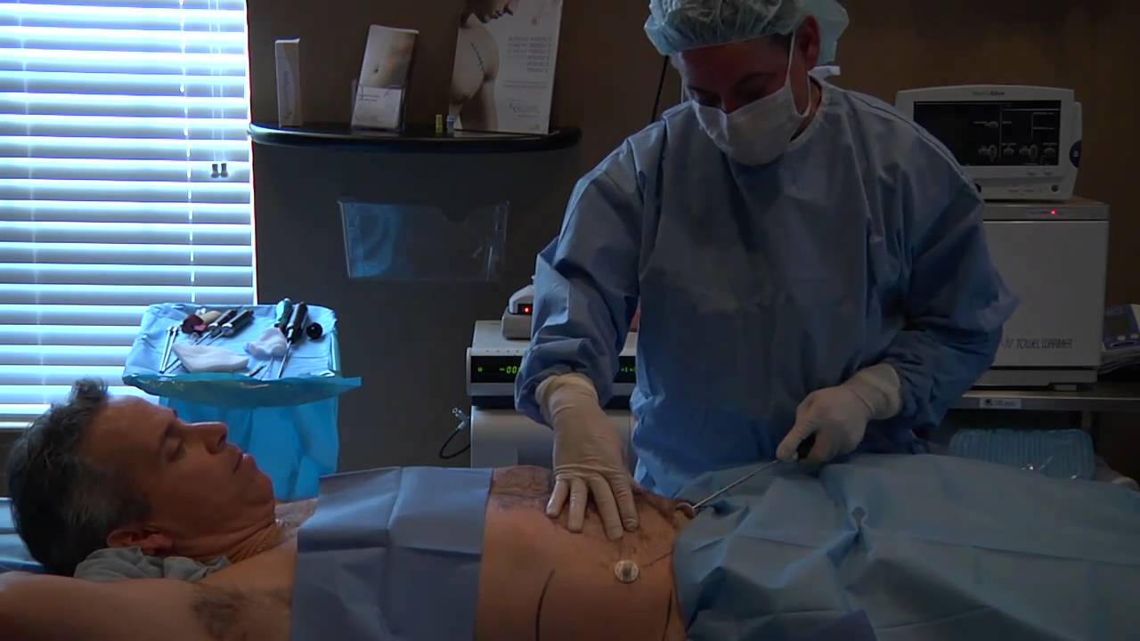 Medical procedure being performed on a patient.