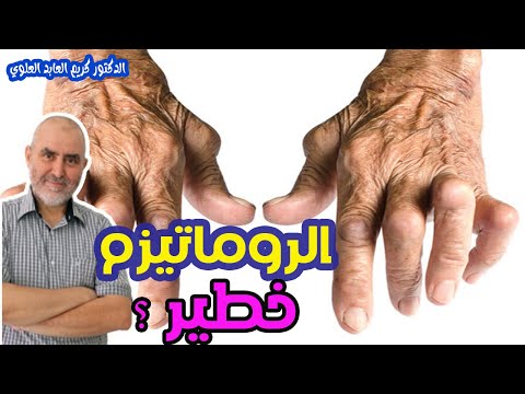 الروماتيزم مرض يجب القلق منه ؟؟    -   الدكتور كريم العابد العلوي  -
