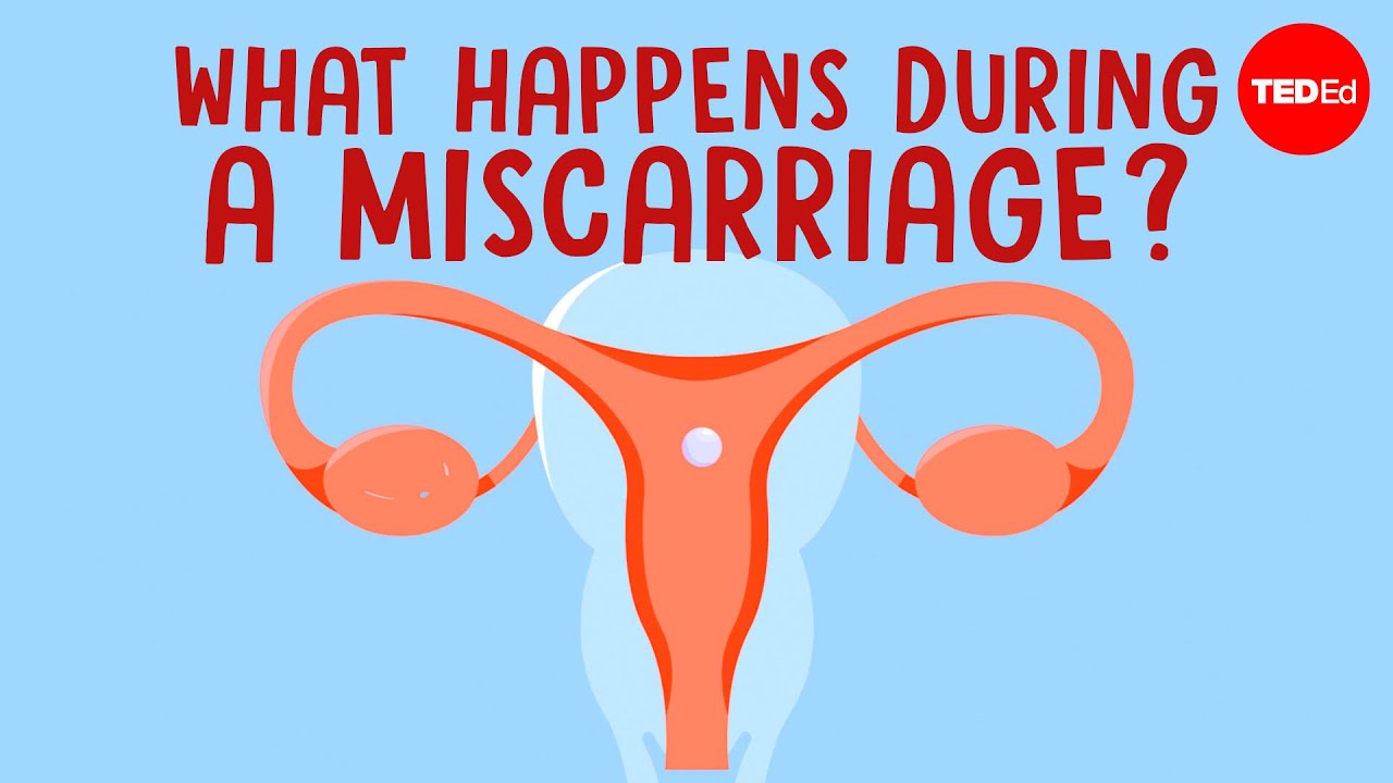 What happens in your body during a miscarriage - Nassim Assefi and Emily M. Godfrey
