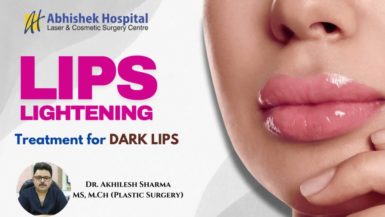 Wart vs. Corn Know the Difference AbhishekHospital