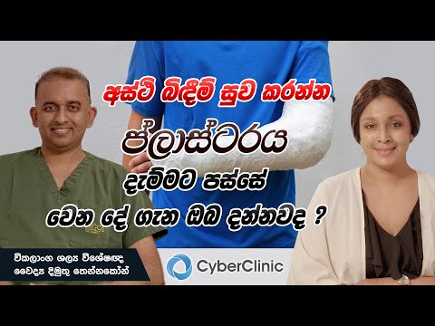අස්ථි බිඳීම් සුව කරන්න ප්ලාස්ටරය දැම්මට පස්සේ වෙන දේ ගැන ඔබ දන්නවද? Cyber Clinic