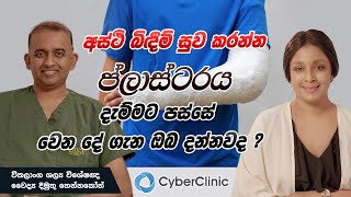 අස්ථි බිඳීම් සුව කරන්න ප්ලාස්ටරය දැම්මට පස්සේ වෙන දේ ගැන ඔබ දන්නවද? Cyber Clinic