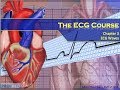 ECG Interpretation and Analysis