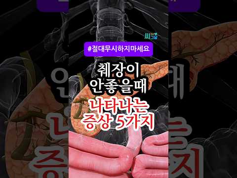 췌장이 안 좋을 때 나타나는 이상 증상 5가지, 절대 무시하지 마세요! #건강정보 #건강