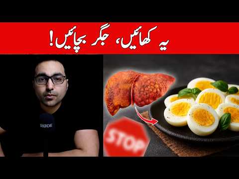 SACH CHUPAYA JARAHA HAI | No. 1 BEST Food to Remove FAT from the LIVER - Dr. Zee