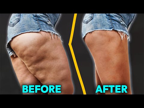 CELLULITE FREE LEGS | WOMEN'S SECRET BEDROOM WORKOUT