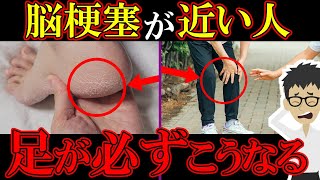 脳梗塞が近い人だけに起こる「足の異変」見逃すと突然倒れます【症状｜前兆｜原因｜脳卒中｜脳出血｜くも膜下出血】