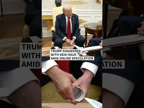 Trump diagnosed with vein issue after leg swelling and hand bruising | AFP #shorts