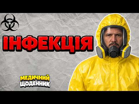 Чума та хот-дог що спільного? Як виникає інфекція?