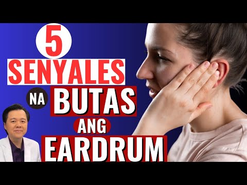 5 Senyales na Butas ang Eardrum. Paano Lunasan Ito. - By Doc Willie Ong.