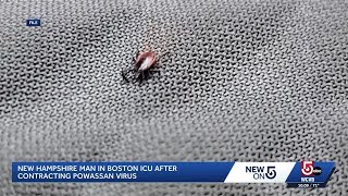 YouTube video thumbnail: New Hampshire man Hospitalized With Rare Powassan Virus After Tick Bite