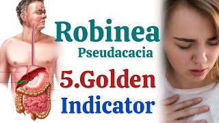 एसिडिटी का कंपलीट पैकेज // Acidity Best Homeopathic Remedy How to Use