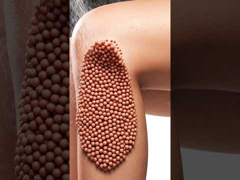 Don’t Watch If You Fear Holes 😨 | Extreme Trypophobia Reveal