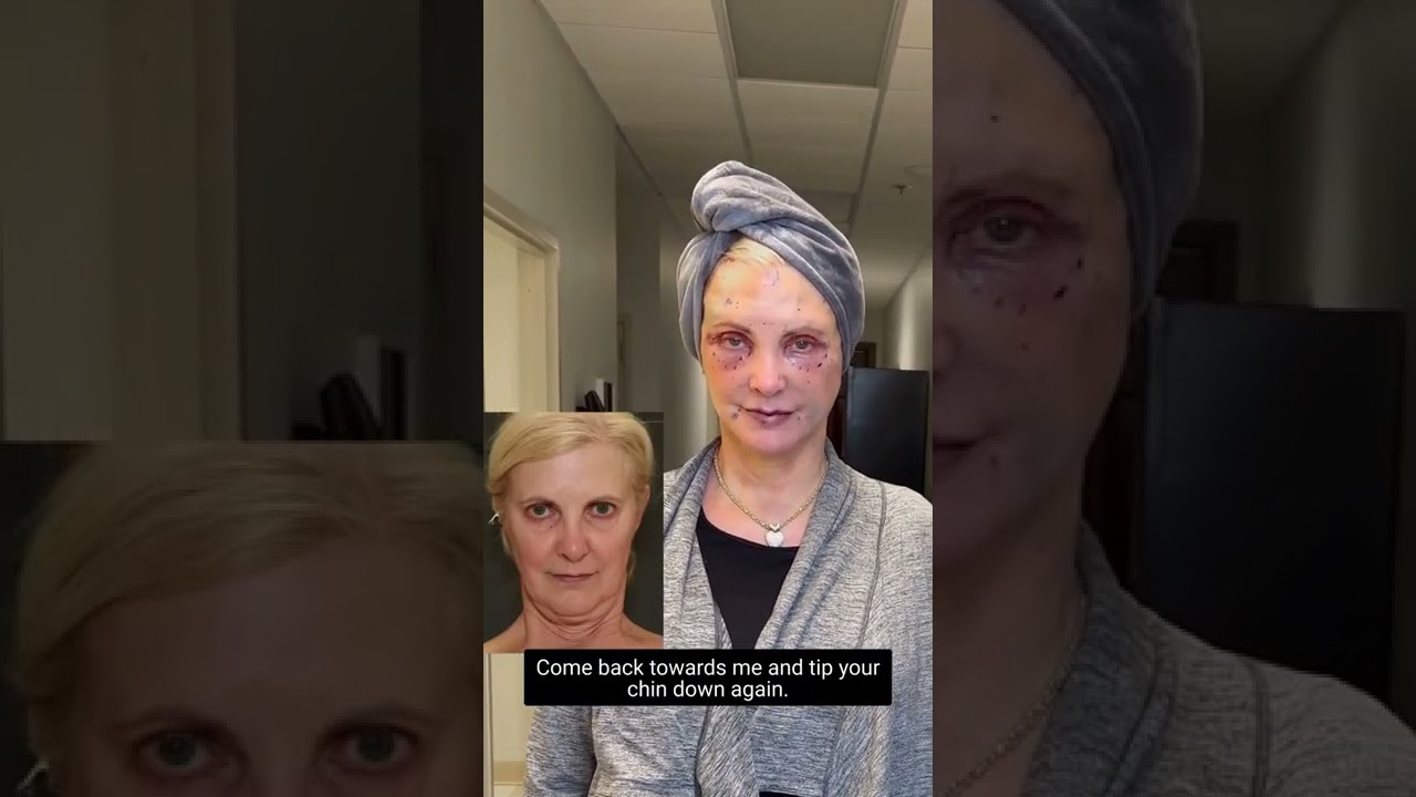 Woman demonstrating facial expression changes.