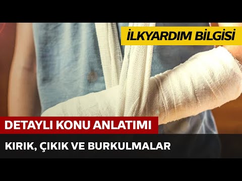 Kırık, Çıkık ve Burkulmalar