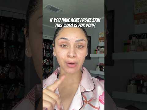 For all my acne prone skin baddies #acne #acneproneskin #acnescars #acneskincare #acnejourney