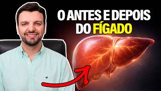 Como REVERTER a GORDURA NO FÍGADO de Forma Natural