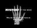 Understanding Skeletons and Bones