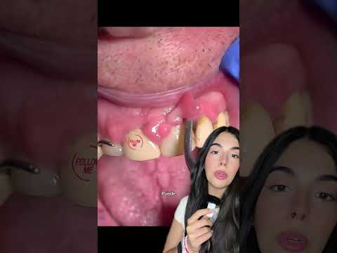 CRECIMIENTO DE ENCÍA #shorts