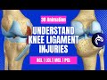 Knee Ligament Injury Assessment