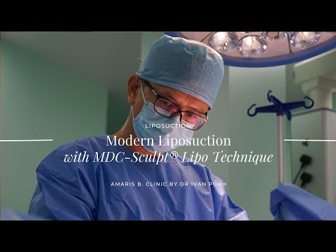 Modern Liposuction with MDC-Sculpt®️ Lipo Technique