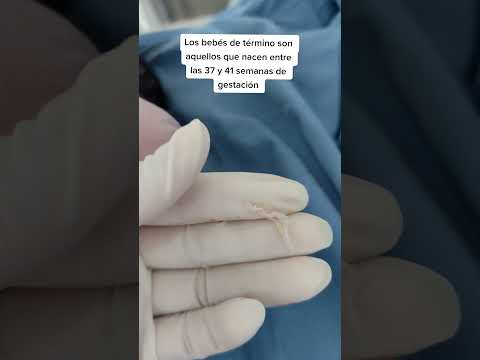 ¿Que pasa por estar mucho tiempo con el líquido amniotico?