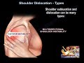 Shoulder Dislocation and Instability Concepts