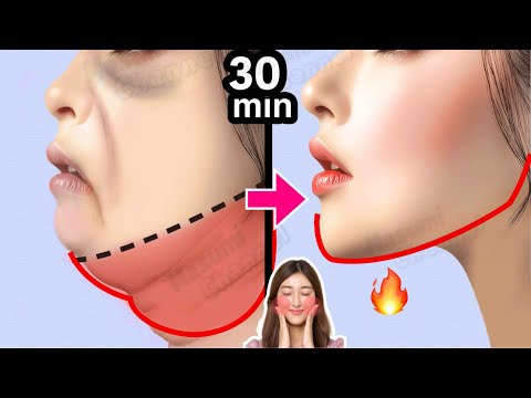 30-Min Jawline Lift Workout to Eliminate Double Chin & Neck Fat🔥
