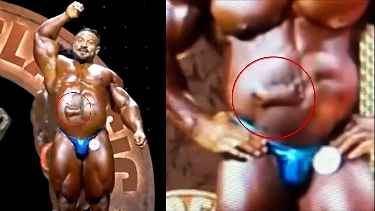 ЧТО СТАЛО С ЖИВОТОМ ВИНКЛААРА на Арнольд Классик-2019? Правда о судорогах