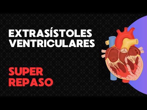 Extrasístoles ventriculares, taquicardia ventricular no sostenida  | Super Repaso