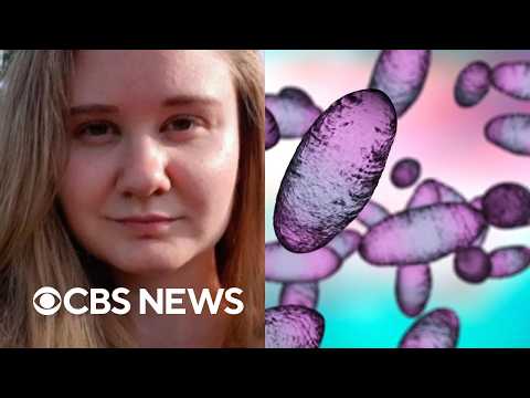 Russia sidesteps WHO request for more info after plague lab worker's death