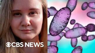 YouTube video thumbnail: Russia Sidesteps WHO Request for More Info After Plague Lab Worker's Death
