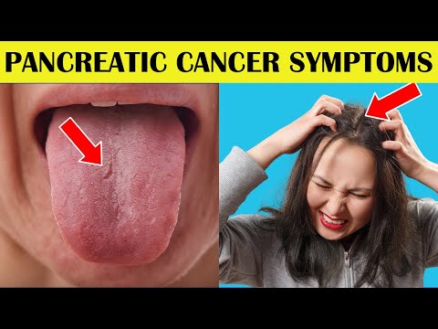 4 Silent Pancreatic Cancer Symptoms That You Shouldn't Ignore