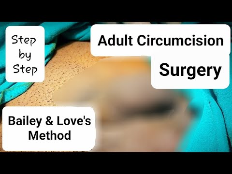 Adult Circumcision - Step by Step Video Based Learning - Dr Tayyab Riaz Ch