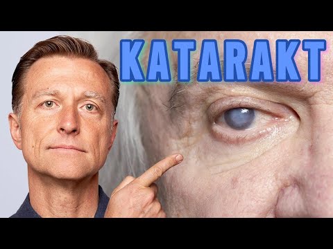 Kataraktı Önlemenin En Etkili Yolu | Dr. Berg Türkçe