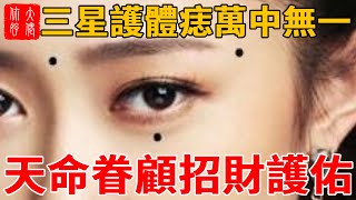天命眷顧！三星護體痣萬中無一，招財護佑，富貴焊死一生！#大佬你好啊#佛說#佛學#佛教#風水#命理#相學