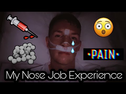 I GOT A NOSE JOB!