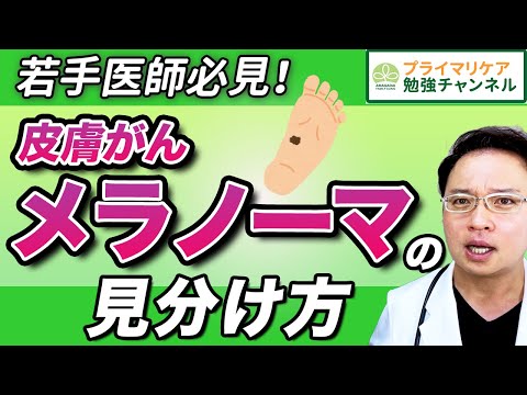 【皮膚がん 見た目からの初期症状の見分け方】ほくろとの見分け方【 詳しく解説! 若手醫師必見】