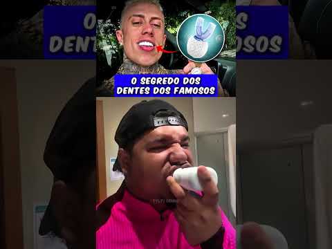 O segredo dos dentes dos famosos #lucastylty #tyltycomp #escovaeletrica #dente #famosos