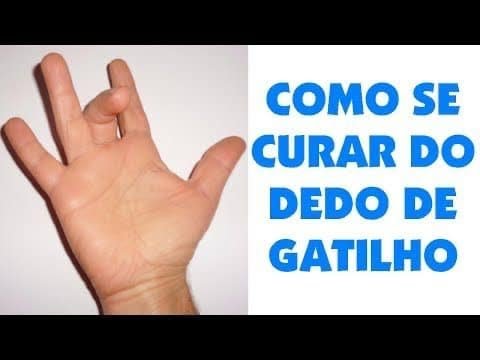 DEDO em GATILHO TENOSSINOVITE ESTENOSANTE CAUSAS & TRATAMENTO Clínica Fisioterapia Dr. Robson Sitta