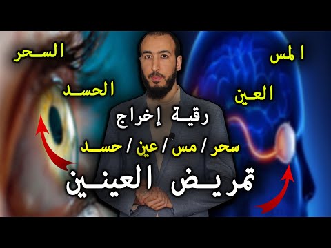 رقية إخراج تمريض العينين من السحر والمس والعين والحسد