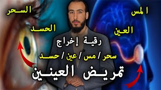 رقية إخراج تمريض العينين من السحر والمس والعين والحسد