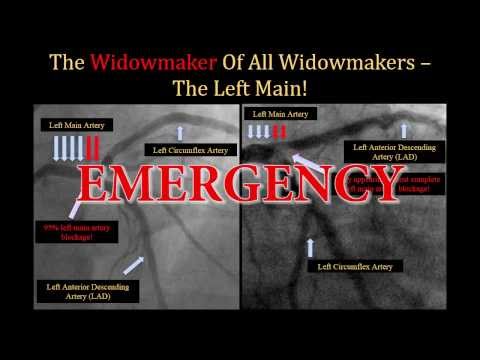 Widowmaking de The Heart Attacks Letra y Video