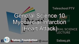 General Science 10 Myocardial Infarction (Heart Attack)